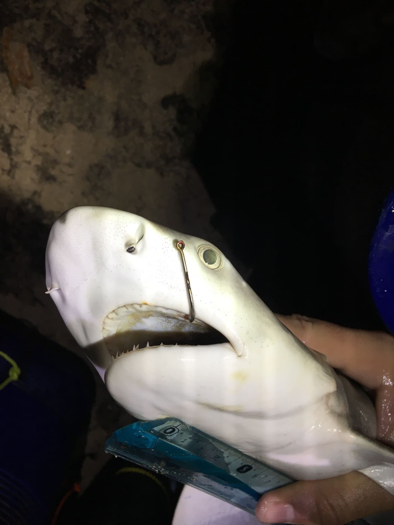 Shark hook injury